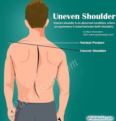 uneven-shoulder.jpg