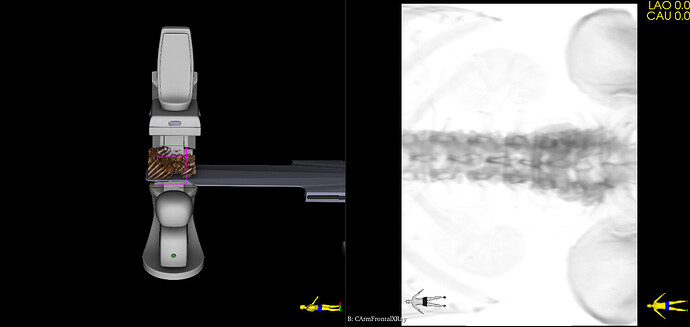 CathLabSimulatorAlternateDefaultCArmPosition