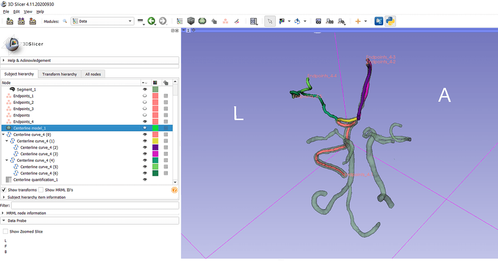 Slicer - Convert centerlines to a graph {V,E} - Support - 3D