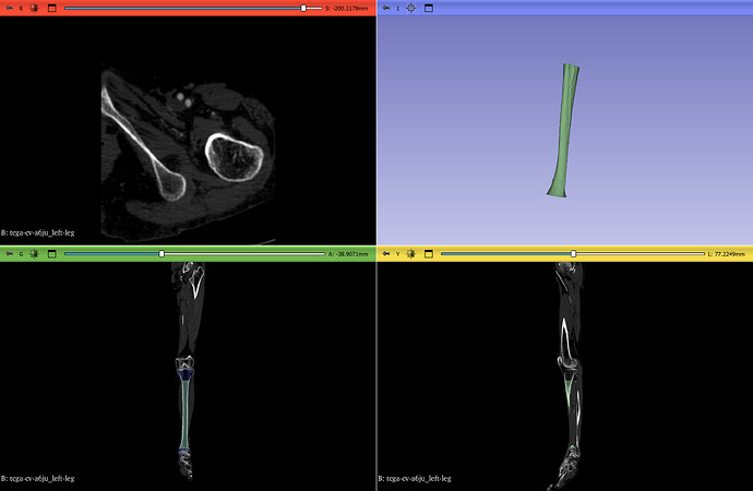 tibia with scribble marks