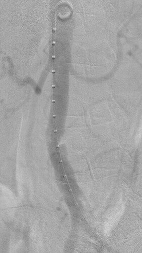 VirtualCathLabProcedural