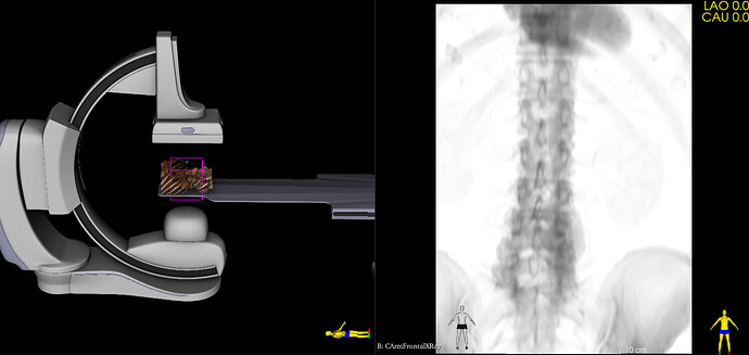 CathLabSimulatorDefaultCArmPosition