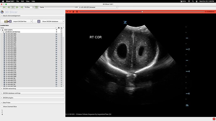 Screenshot 2025-10-29 at 3.46.06 PM