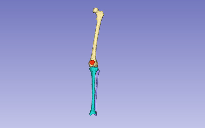 TotalSegmentator 1