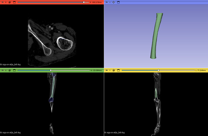 Femur with scribble marks