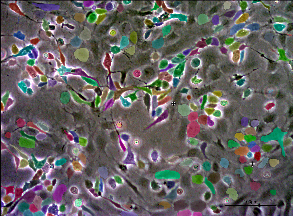 Cellpose GUI accuracy metric concern - Image Analysis - Image.sc Forum