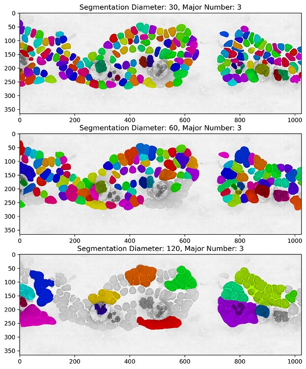 Cellpose4 (Cellpose-SAM) tests - Image Analysis - Image.sc Forum
