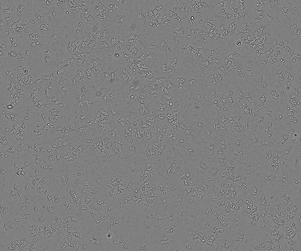 Help segmenting bright field images using cellpose3 - Image Analysis ...