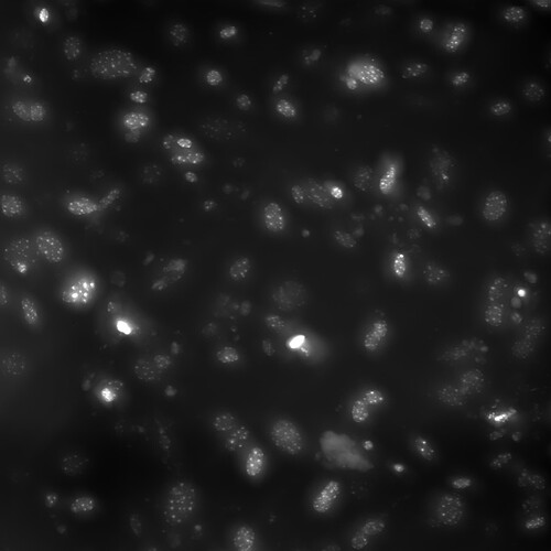 BIOP Cellpose plugin for FIJI - Usage & Issues - Image.sc Forum