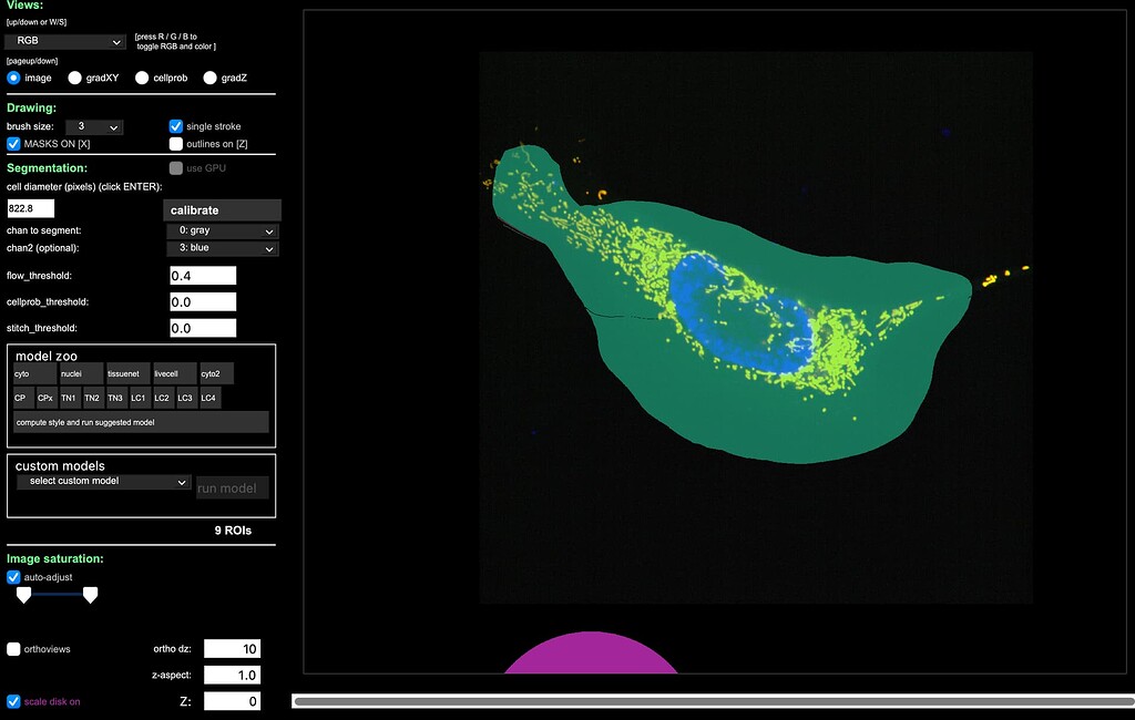 Cellpose ROI Lines/Striations Bug - Image Analysis - Image.sc Forum