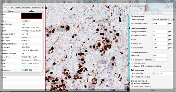 Adjustment of cell detection tool (ki67) - Image Analysis