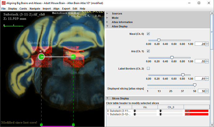 Register part of a section with brainreg - Image Analysis