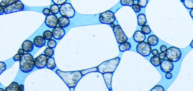 Cellpose4 (Cellpose-SAM) tests - Image Analysis - Image.sc Forum