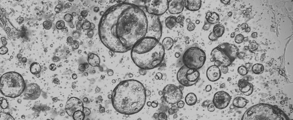 Cellpose4 (Cellpose-SAM) tests - Image Analysis - Image.sc Forum