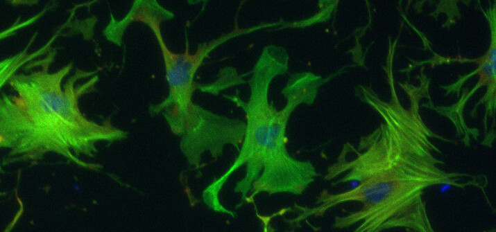 Cellpose4 (Cellpose-SAM) tests - Image Analysis - Image.sc Forum