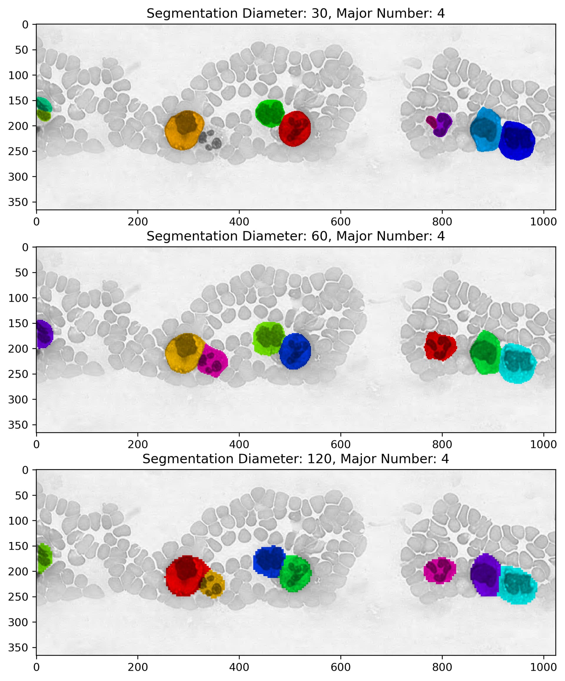 Cellpose4 (Cellpose-SAM) tests - Image Analysis - Image.sc Forum