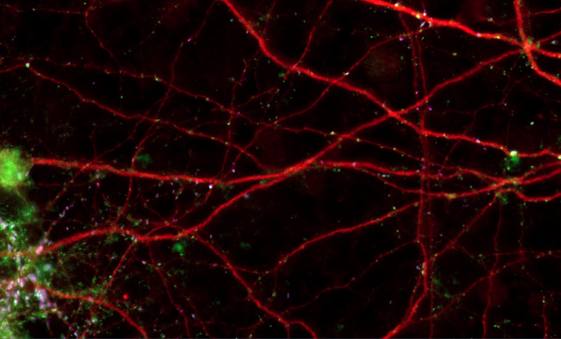 Spatial Colocalization Count colocalized spots - Image Analysis - Image.sc Forum