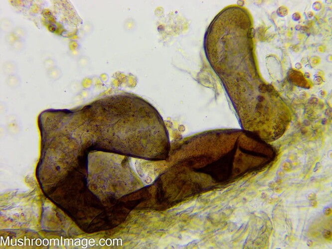 lycogalaspaeroconicum40x5123082025bakunkarrvalmi