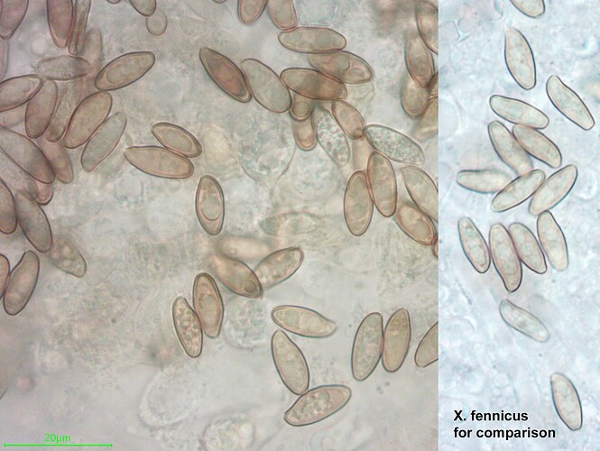 Xerocomellus-cisalpinus-20230814-micr