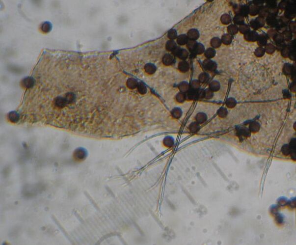 Diacheopsis_effusaM0522P