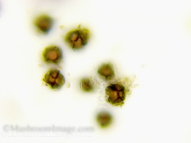sclerodermacitrinumspores100x3