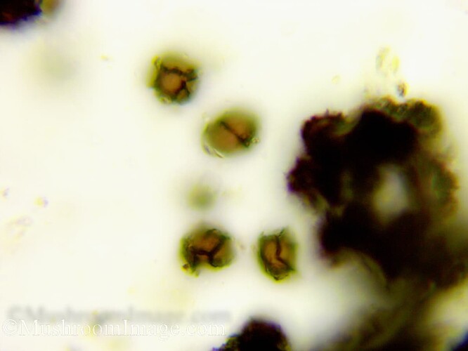 sclerodermacitrinumspores100x7