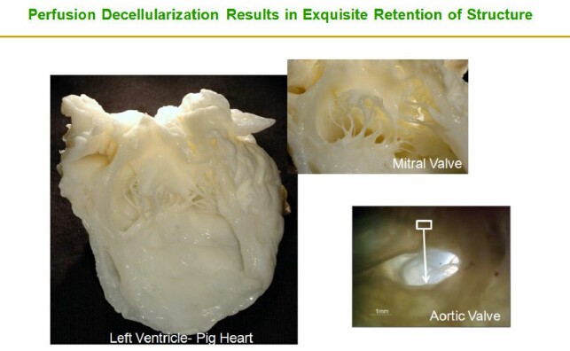 Decellularized-pig-heart-As-published-by-Ott-et-al-perfusion-decellularization-is