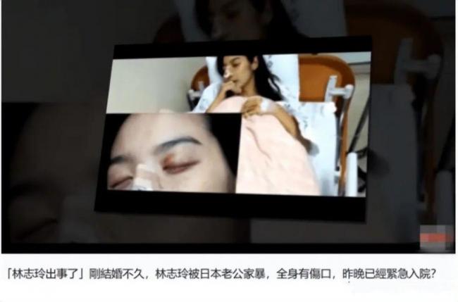 有图有真相？台媒再曝林志玲惨遭家暴